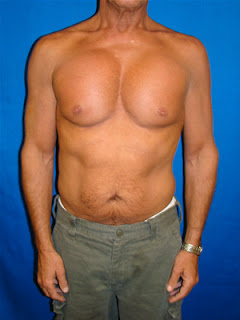 Professional Mma Fighters Professional Mma Fighters