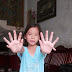 Kỳ lạ cô bé có 24 ngón tay, chân ở Quảng Nam