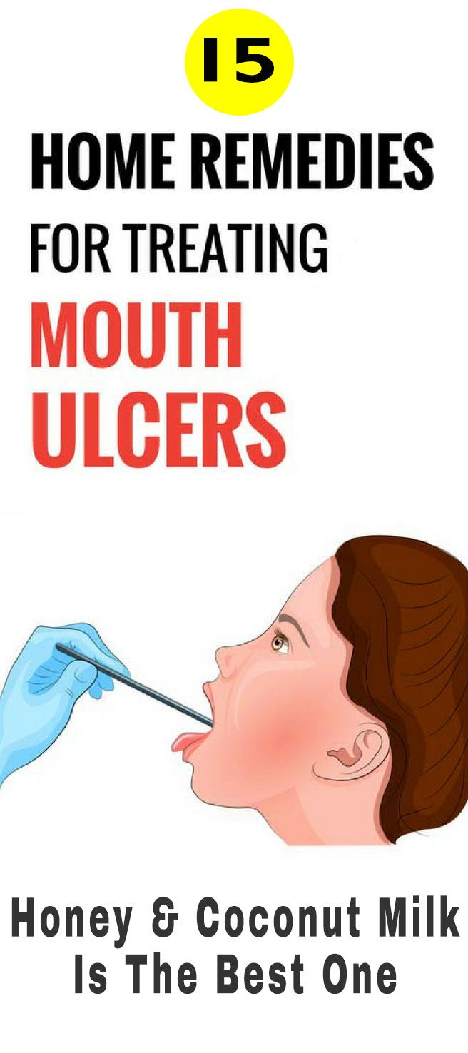 15 Home Remedies For Mouth Ulcers Honey And Coconut Milk Theraphy 2