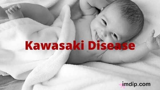 kawasaki disease kawasaki disease, imdip.com, imdip, #imdip