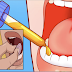 In 2 Minutes - How To Relieve The Pain Caused By Toothache