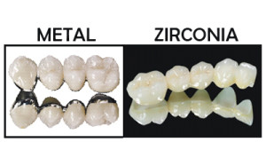 Zirconia