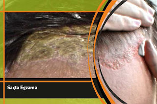 guzellik saclardan baslar blogger