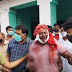 पूर्व मंत्री बीमा भारती के पति अवधेश मंडल पर जानलेवा हमला, एक अन्य घायल  