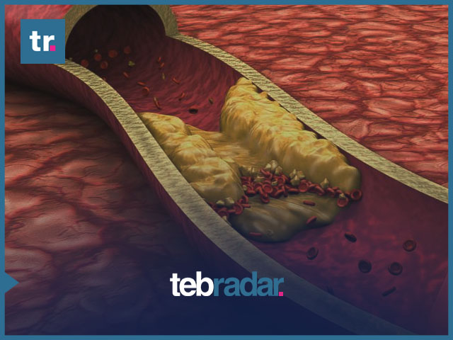 9 تجارب تساعد على خفض نسبة الكولسترول بسرعة في أسبوع