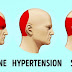 An Effective Way To Naturally Stop A Headache In Only Five Minutes