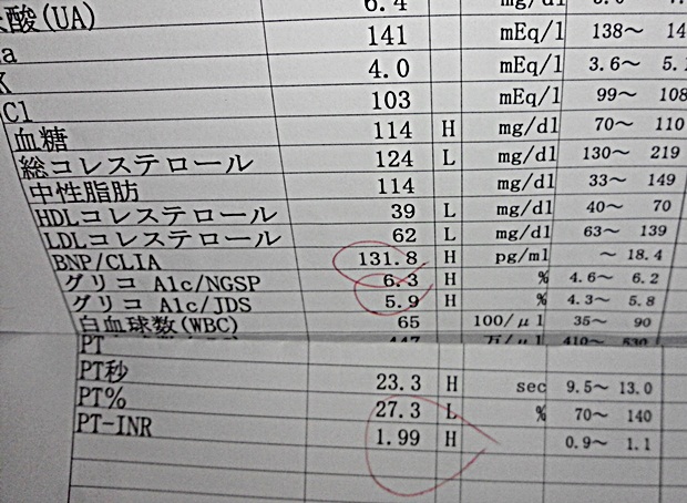 低コレステロール：なぜ健康に悪いのですか？