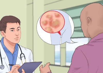Foto Berapa Biaya Pengobatan Kutil Di Labia Minora Di Dokter Dan Alternatif