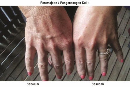 cara aman mengencangkan kulit tangan