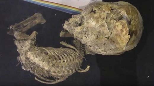 Feto encontrado en Bolivia demostraría que existió en la antigüedad una raza con las cabezas elongadas