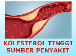 penyakit kolesterol tinggi sumber penyakit