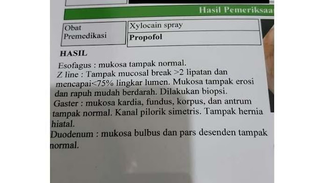 Makan Setengah Kardus Mie Instan dalam Seminggu, Tubuh Pria ini Mendadak Berubah Drastis, Gak Bakal Nyangka