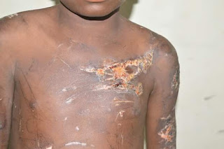 FB IMG 1516719852985 Photos: Man arrested in Nassarawa State for causing grievous bodily injury on his 12- year-old son