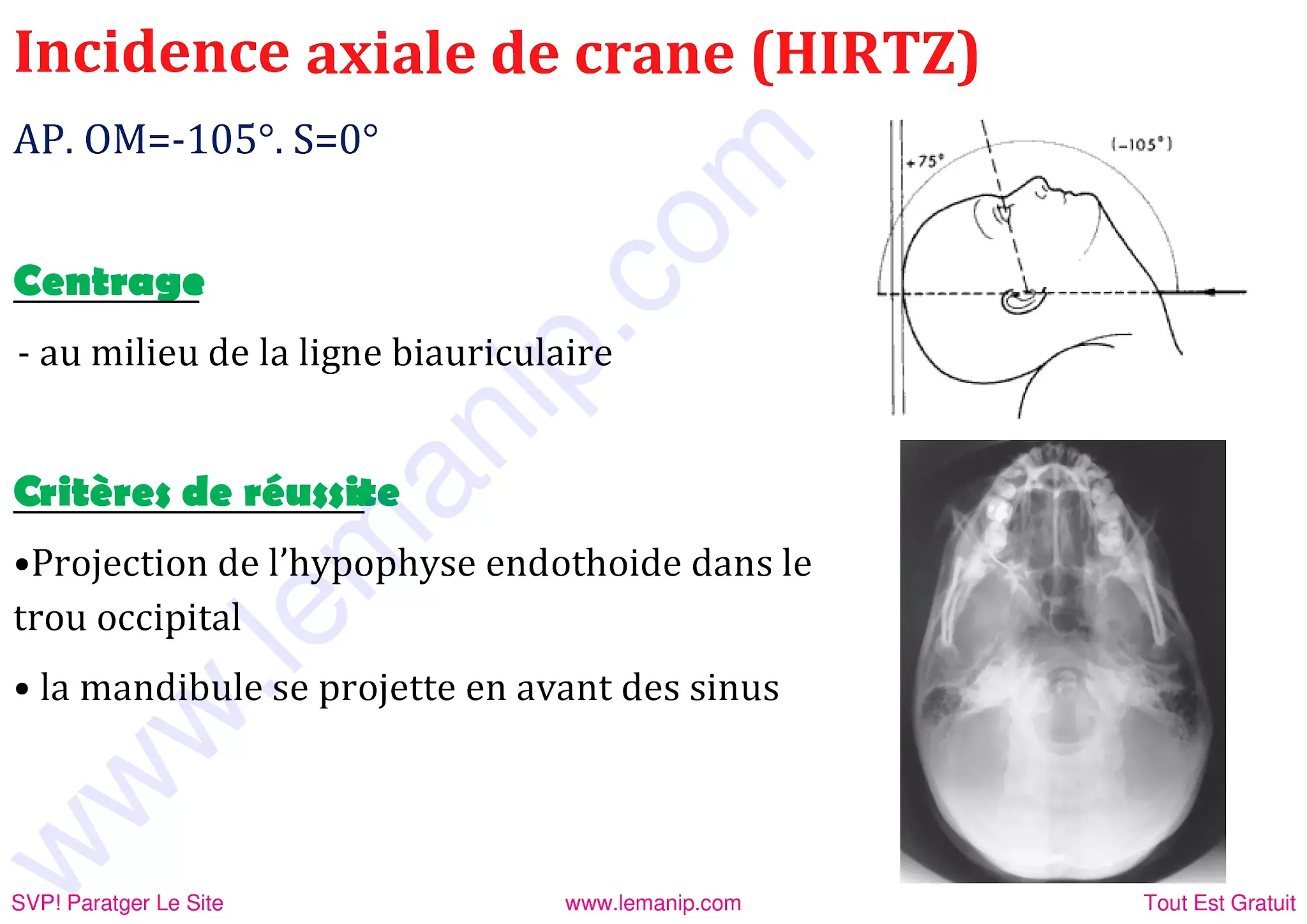 crane axiale hirtz