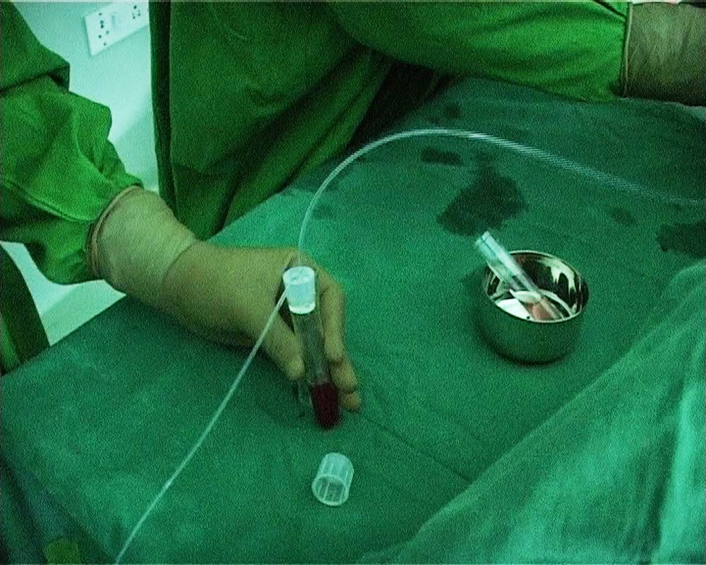 This and That Test Tube Baby IVF