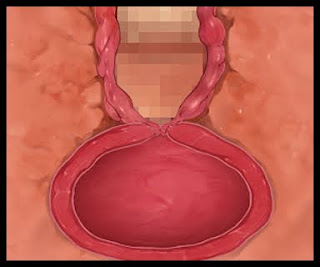 [CG] Bitchy Boss Bimbofication