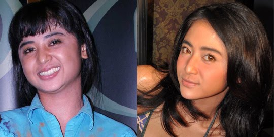 Dewi Persik Operasi Plastik | Dunia Operasi Plastik