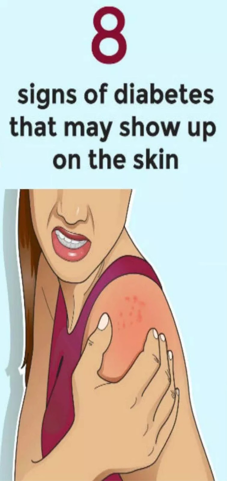 8 Signs Of Diabetes That May Show Up On The Skin KrobKnea