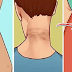 How To Remove Thos Dark Ugly Patches in Your Neck, Underarms And Thighs in Just 15 Minutes