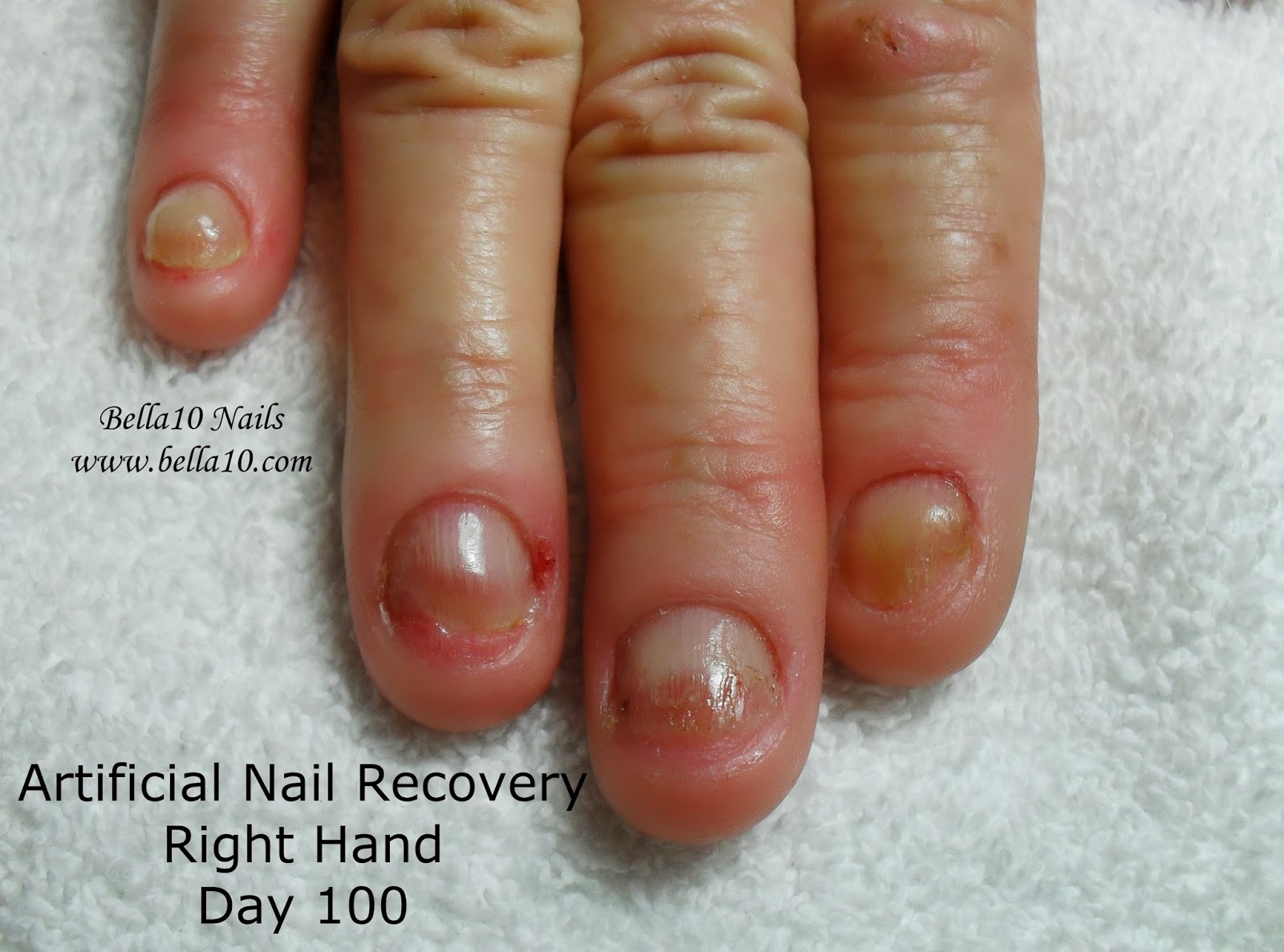 Bella10 Nails The Secret to Artificial Nail Recovery