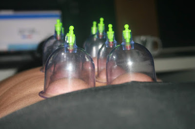 fisioterapia são joão da boa vista