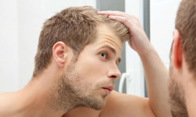 Male hair loss 2019