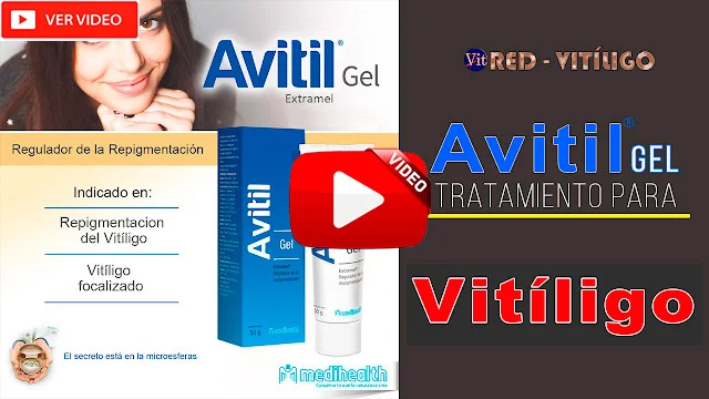 AVITIL GEL PARA CURAR EL VITILIGO