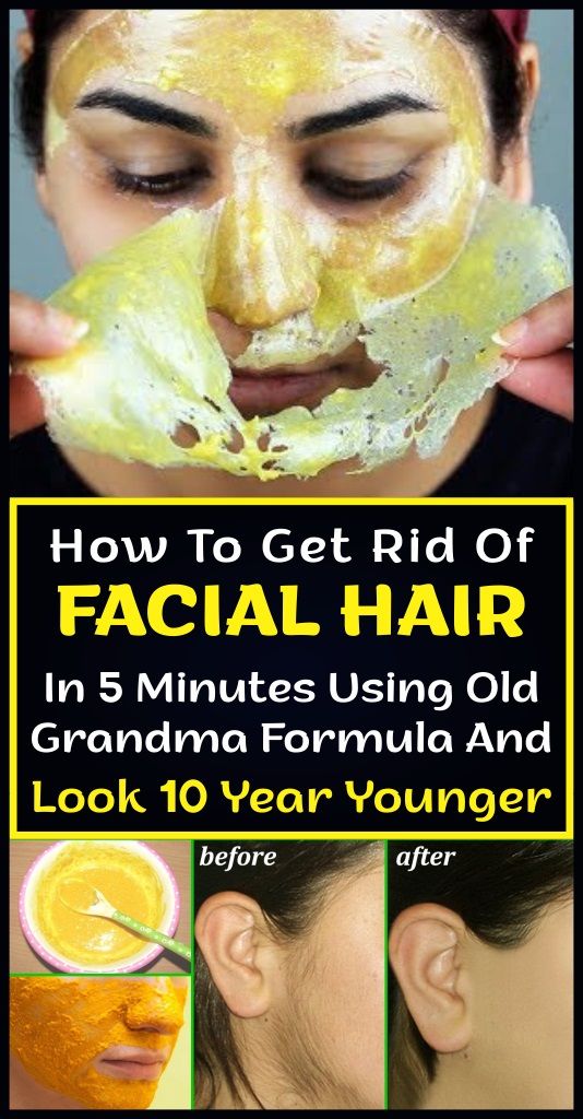 How To Get Rid Of Facial Hair In 5 Minutes Using Old Grandma Formula And Look 10 Year Younger