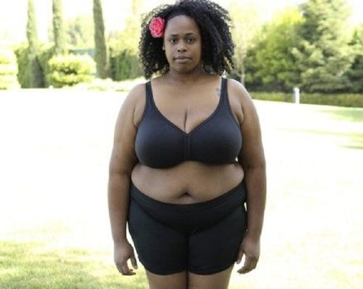 When Being Overweight Is a Health Problem