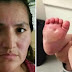 Bebê fica com bolhas enormes em seus pés. Mas depois, sua mãe descobre o que a babá horrível fez!