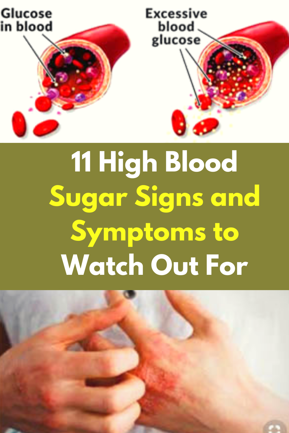 11 High Blood Sugar Signs and Symptoms to Watch Out For