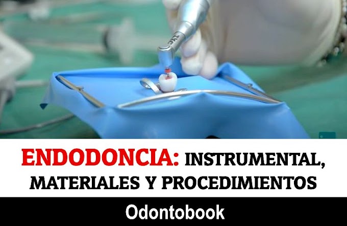 ENDODONCIA: Instrumental, Materiales y Procedimiento Quirúrgico