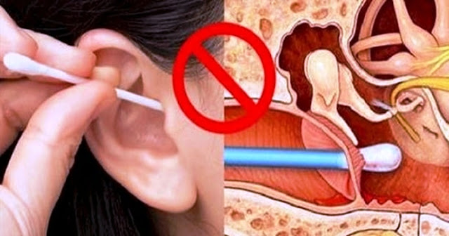 Nettoyage des oreilles avec un coton-tige, c'est dangereux?