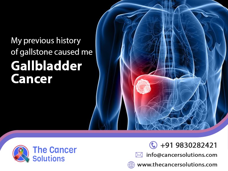 My previous history of gallstone caused me gallbladder cancer - The ...
