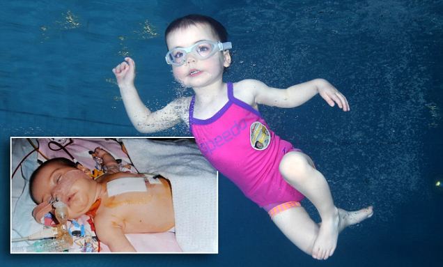 BLOG USANG: Bayi Ajaib Mampu Berenang Selepas Pembedahan 