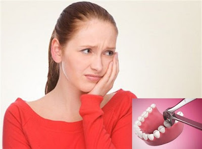 Nếu nhổ răng xong bị đau nhức thì phải làm sao?-1