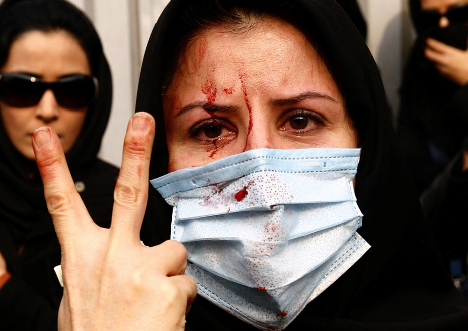 Manifestante herida, haciendo el signo de la paz y la victoria (Teherán, Junio 2009) Amir Sadeghi.