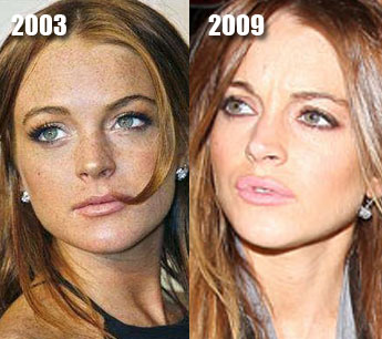 Lindsay Lohan Before And After Weight Loss