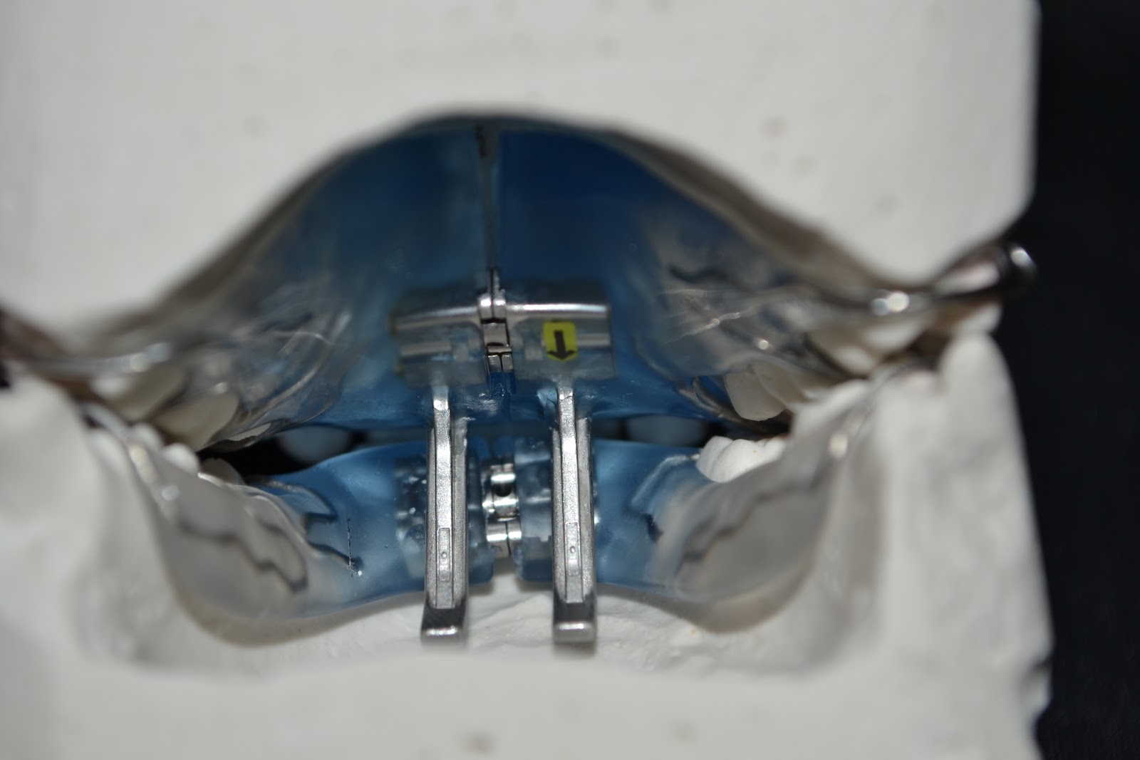 Ortodonzia Fissa · Mobrici-Rastelli - Foto 4