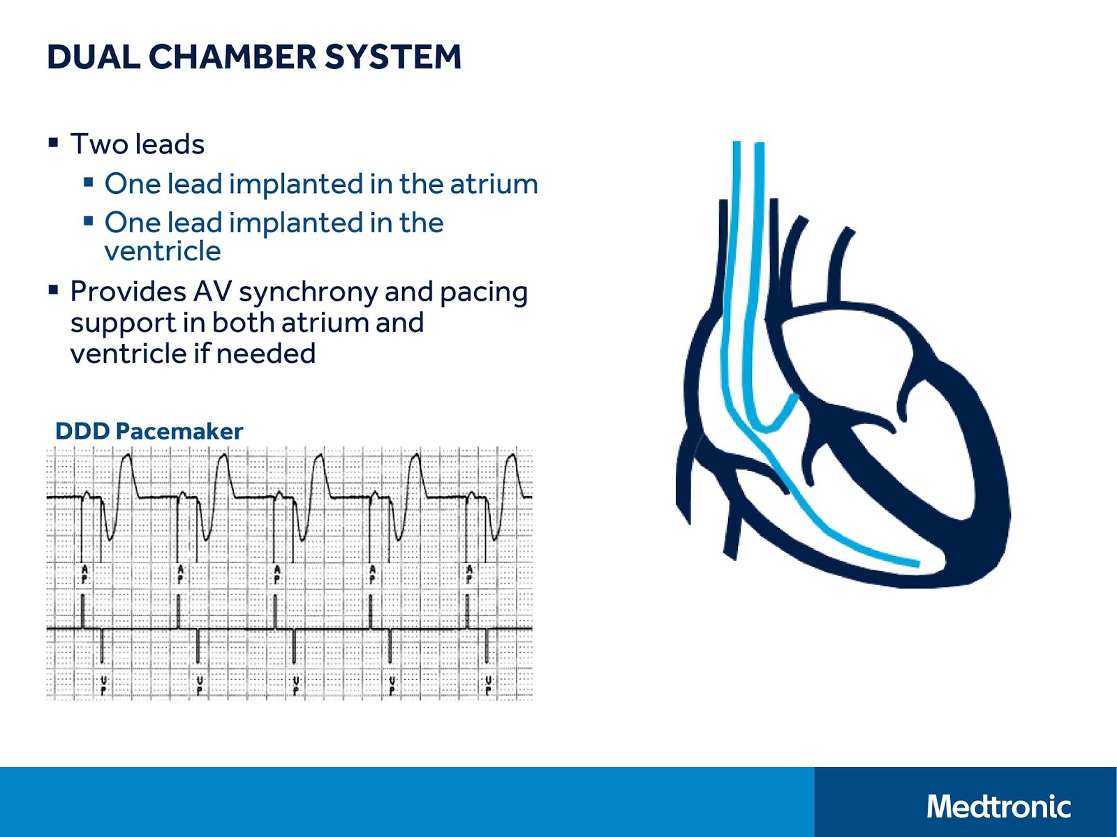 CVT Mohd Farid Basic Pacing Concepts Part IMedtronic Academy