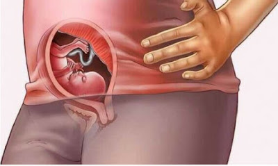 أعراض الحمل  أعراض الحمل