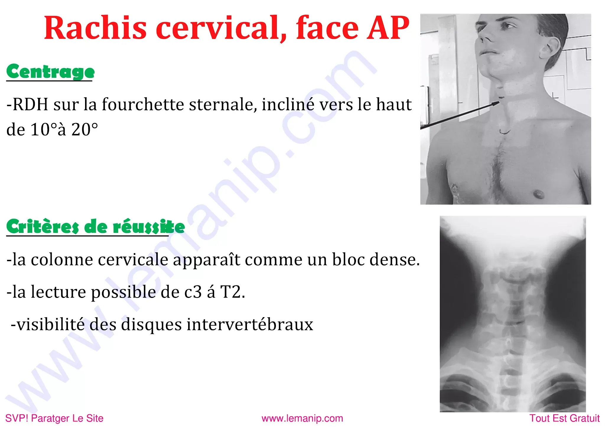 rachis cervicale de face