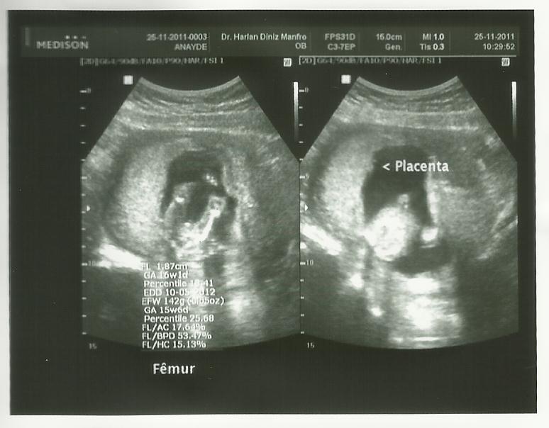 Minha 2ª gravidez 16 semanas