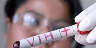 SALUD: Alza en casos de VIH Sida: demandan campañas de prevención y detección temprana.