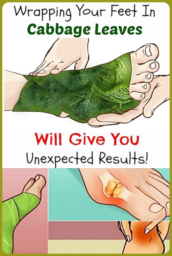 Why Should You Wrap Your Joints In a Cabbage Leaf? wellness days