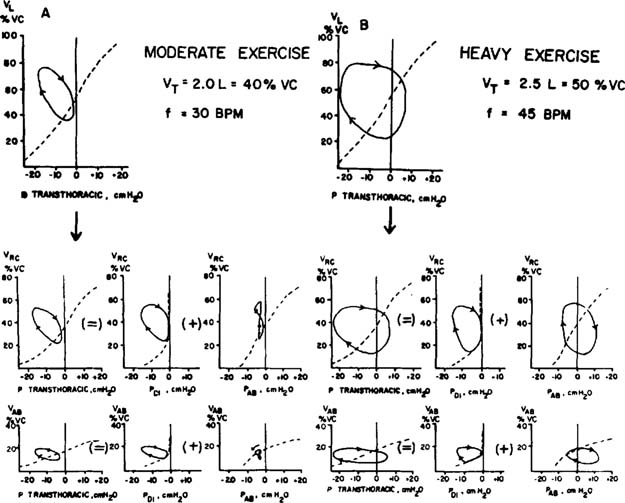 calculating tidal volume calculating tidal volume