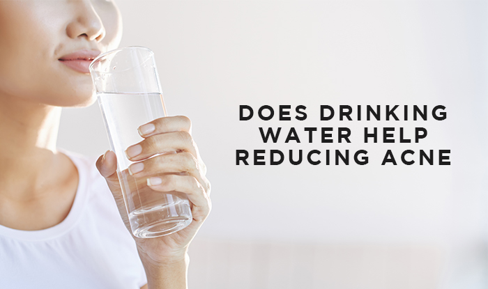 Does Drinking Water Help Reducing Acne