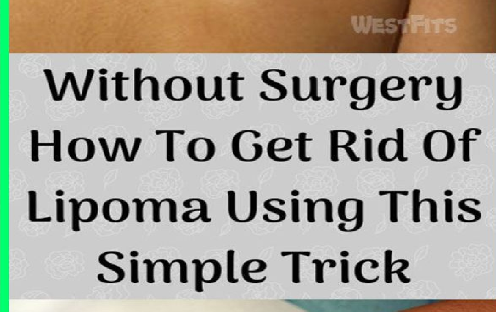 You Have A Ball Of Fat Under Skin Check These Natural And Effective