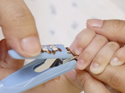 Bayi Dikerat Dua | LadyBird's Life