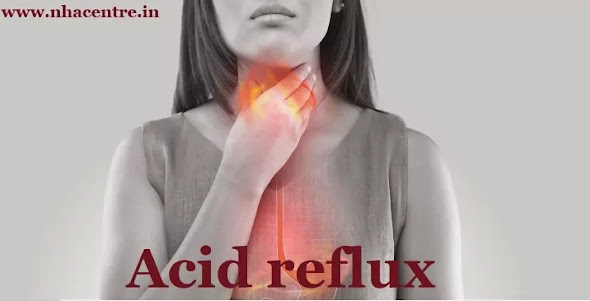 how to cure acidity